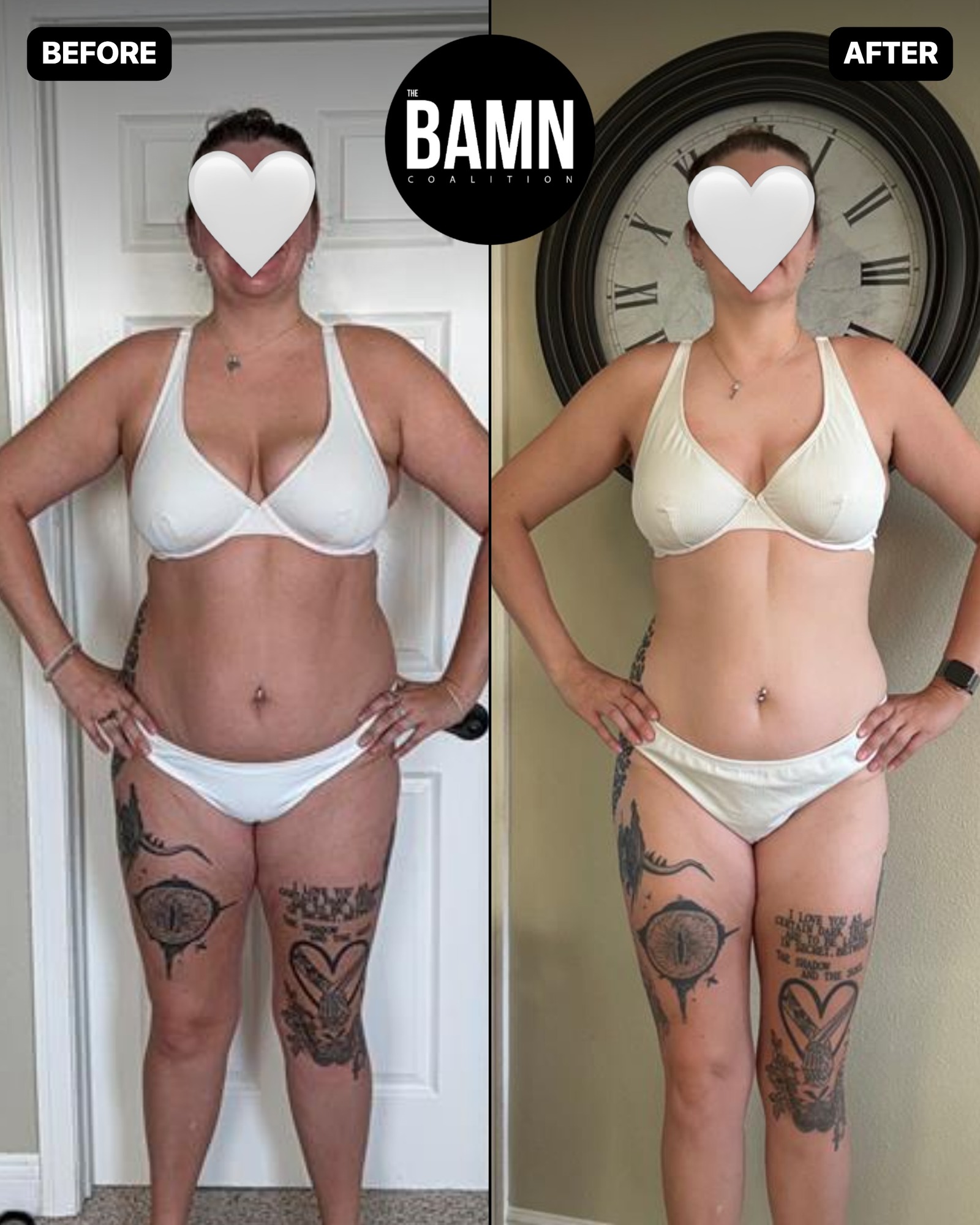 Mackenzie, a client of Addison Shields, before and after from the front, 1 of 4